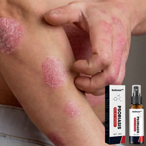 PAGA 1 LLEVA 2 KOLMAX®: Dile adiós a la Psoriasis (APROVECHA HOY)