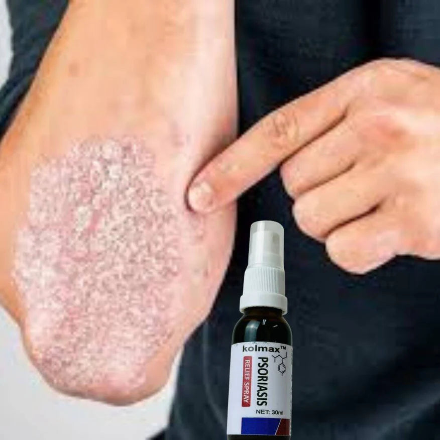 PAGA 1 LLEVA 2 KOLMAX®: Dile adiós a la Psoriasis (APROVECHA HOY)