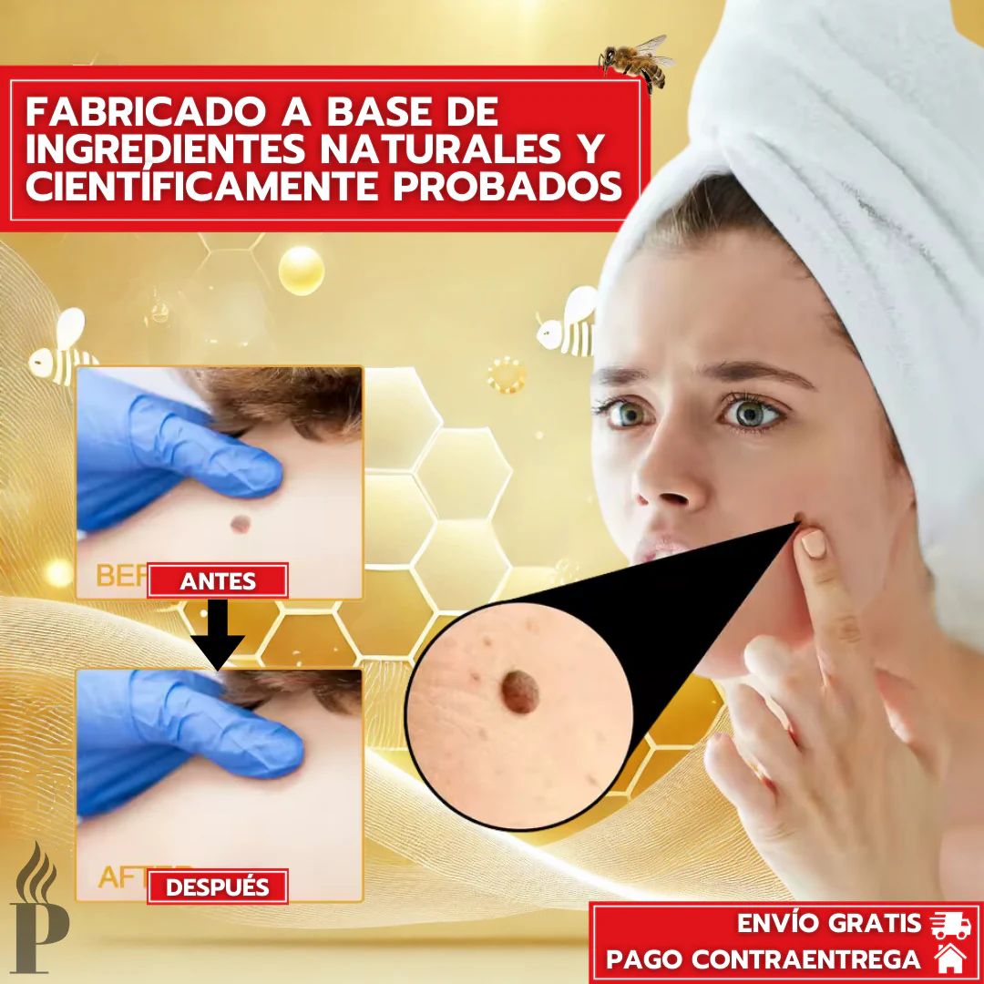 PAGA 1 LLEVA 2 TAG RECEDE®: Eliminador de Verrugas y Manchas (ORIGINAL)