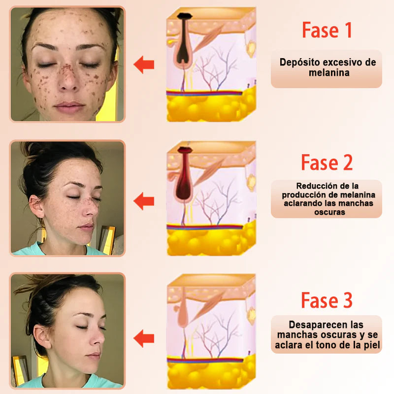 PAGA 1 LLEVA 2 Jorondy: Exfoliante y Aclarador de Manchas