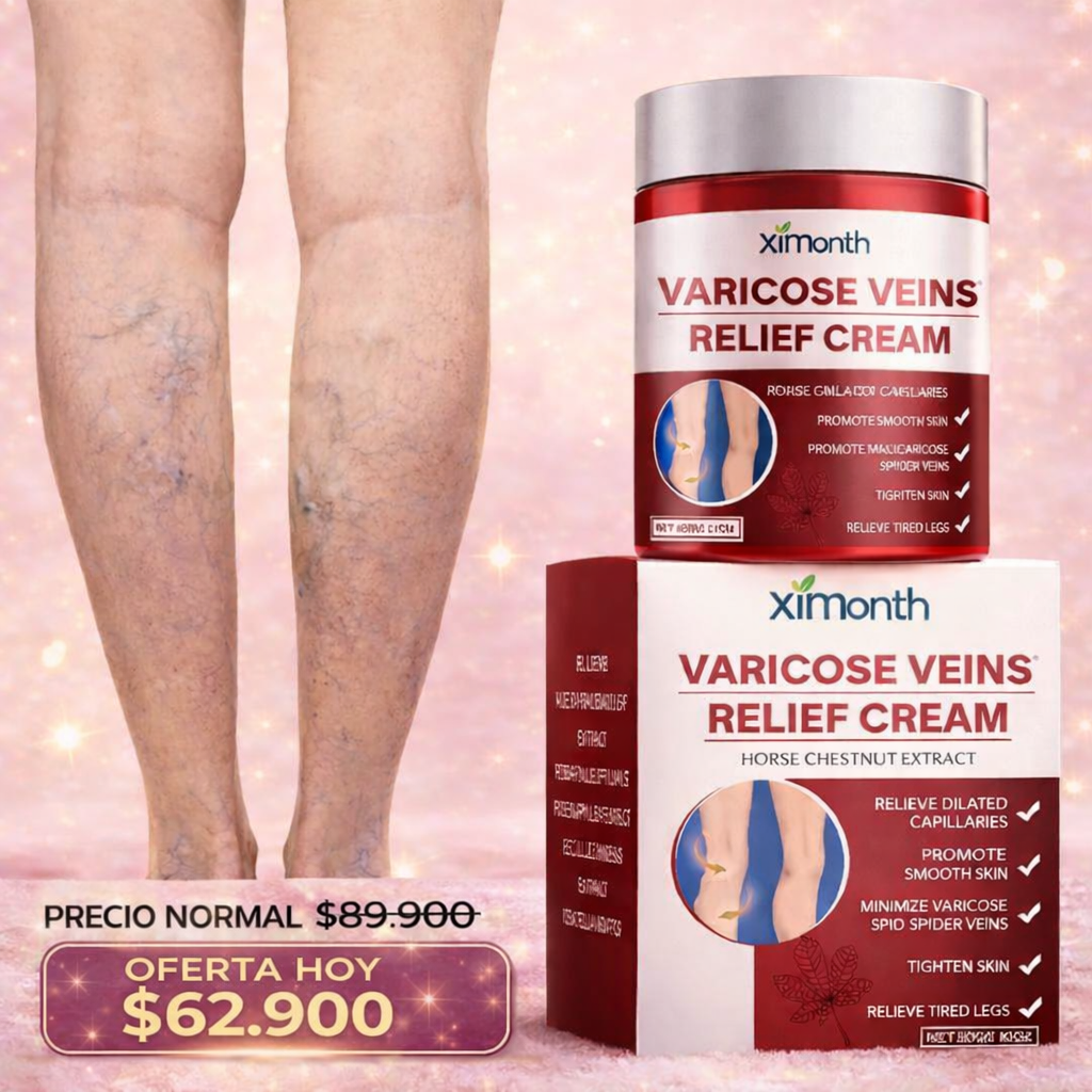 OFERTA HOY Crema VenaLux® - Alivia Las Varices y Arañitas (MEJOR PRECIO)