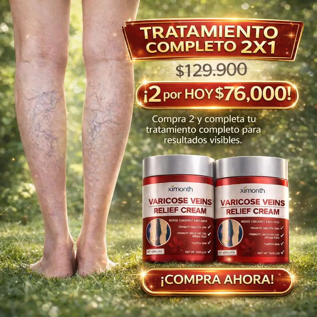 LLEVA 2 UNIDADES Crema Para Varices® - Alivia Las Varices y Arañitas (100% Original)