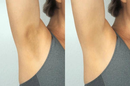 PAGA 1 LLEVA 2 Jorondy: Exfoliante y Aclarador de Manchas